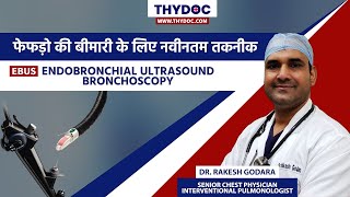 EBUS  Endobronchial Ultrasound Bronchoscopy EBUS Test Dr Rakesh Godara Jaipur [upl. by Parette660]