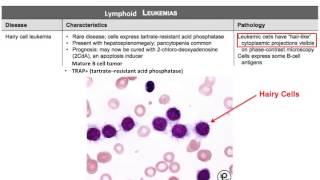 USMLE® Step 1 High Yield Oncology Leukemia [upl. by Ecirtael]