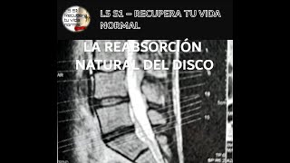 HERNIA DISCAL L5 S1  RECUPERA TU VIDA NORMAL LA REABSORCIÓN NATURAL DEL DISCO [upl. by Zacharias623]