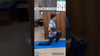 Exercise for Hyper lumbar Lordosis Lumbar lordosis lumbarlordosis posturecorrection [upl. by Lindy]