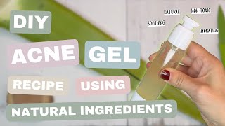 How to Make DIY Acne Gel at Home [upl. by Aeli]