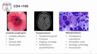 HIV Clinical Disease and Opportunistic Infections [upl. by Enoed535]