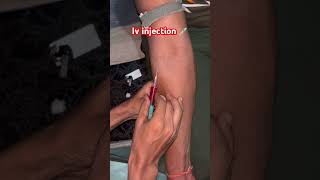 Iv injection viralvideo li [upl. by Tigirb128]