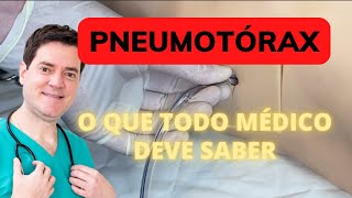 PNEUMOTÓRAX O QUE TODO MÉDICO DEVE SABER [upl. by Younger294]