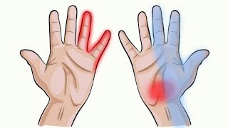 7 Things Your Hands Can Tell You About Your Health [upl. by Leith459]