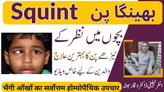 Squint بھینگا پن भेंगापन Homeopathic Treatment by Dr Waqar Bhutta In Urdu  Hindi [upl. by Eelyam]