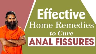 Effective Home Remedies To Cure Anal Fissures  Swami Ramdev [upl. by Nairbo]