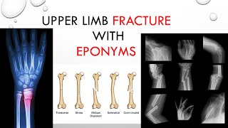 Fracture with Eponyms upper limb [upl. by Nylzzaj]