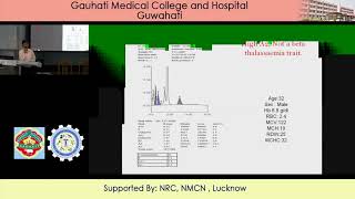 Essential Information about measuring and interpreting thalassaemia and haemoglobinopathy Dr Soumen [upl. by Manfred]