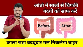 Homeopathic medicine for detox intestines constipation Homeopathic medicine [upl. by Nyladnarb]