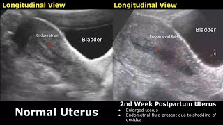 Gynecological amp Obstetric Ultrasound Normal Vs Abnormal Scan  Uterus Ovary Cervix Pregnancy USG [upl. by Nilyak]