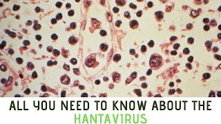 All you need to know about the Hantavirus [upl. by Sennahoj]