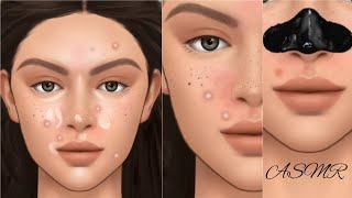 ASMR Remove acne and black dots asmr animation skin care [upl. by Rachael]