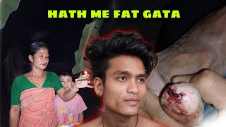 Diwali ke din  Bom 💣Fat gaya hath me  Hindi  Vreegu Vb [upl. by Yelsna]