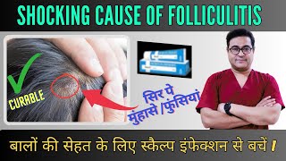 Shocking Causes Of Folliculitis You Never Knew  Cause Symptoms amp Treatment  follicullitis [upl. by Garris566]