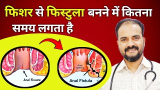 Fissure se Fistula KAISE banta hai  fissure and fistula difference in hindi  dr sarvez ansari [upl. by Graniela]