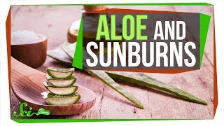 Does Aloe Really Treat a Sunburn [upl. by Lamaaj]