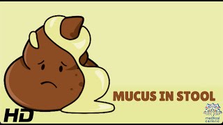 Mucus In Stool Everything You Need To Know [upl. by Enovaj]