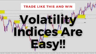 How To Trade Volatility Indices Institutional Trading Strategies [upl. by Gonzalez136]