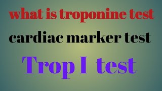 trop I test for heart attack   myocardial infarction in hindi [upl. by Gerianne]