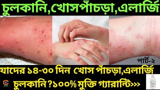 খোস পাঁচড়া ঔষধ।Scabies Treatment bangla😫 স্ক্যাবিস চিকিৎসা।Scabis।খোস পাঁচড়া।চর্মরোগ​ চিকিৎসা [upl. by Phippen]