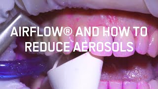 Airflow® and how to reduce aerosols [upl. by Lucais]