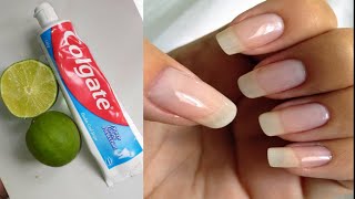 Cómo hacer crecer las uñas más rápido y más fuerte en 7 días con limón y colgate sin salir de casa [upl. by Sands]