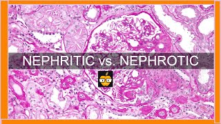 Nephritic vs Nephrotic Syndromes [upl. by Nered88]