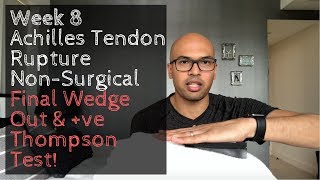 Week 8 Achilles Tendon Rupture NonSurgical  Final Wedge Out amp Positive Thompson Test [upl. by Aiciram37]