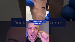 Dermatologist reacts to gnarly corn removal dermreacts doctorreacts footcorn [upl. by Mcevoy594]