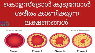 കോളസ്ട്രോൾ കൂടുമ്പോൾ ശരീരം കാണിക്കുന്ന ലക്ഷണങ്ങൾ Symptoms of high cholesterol in the bodymalayalam [upl. by Nimaj225]