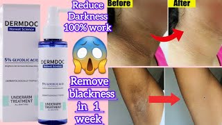 Dermdoc 5 glycolic acid underarms treatment treat dark underarms  reduce uneven skin amp blackness [upl. by Budworth990]