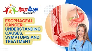 🩺 Understanding Esophageal Cancer Symptoms Treatment and Care 🩺 [upl. by Bouchier]