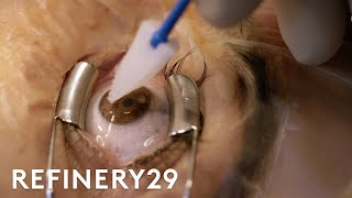 What Getting Laser Eye Surgery Is Really Like  Macro Beauty  Refinery29 [upl. by Mather]