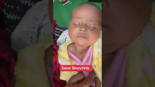 Severe Bronchitis drataurrahman newbornbaby baby crezyboy [upl. by Onibas]