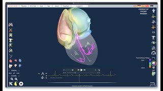 Introductory lecture on Epicardio Simulation™  ECG [upl. by Ilrahs]