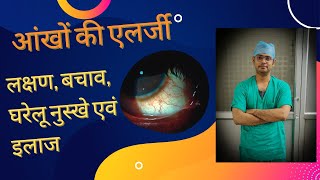 Allergic conjunctivitis eye allergy redness itching watering causes home remedies and treatment [upl. by Araec]