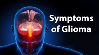 Symptoms of Glioma [upl. by Llennoj314]