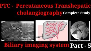 Percutaneous Transhepatic Cholangiography  PTC  Procedure  Biliary imaging system part  5 [upl. by Crowell86]