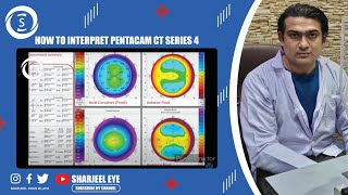 How to interpret pentacam CT series 4 [upl. by Alitha960]