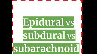 Epidural vs Subdural vs Subarachnoid hematoma [upl. by Gleda]