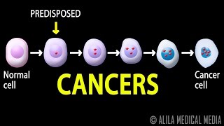 Cancer How Cancer Starts How Cancer Spreads Where and Why Animation [upl. by Emya]