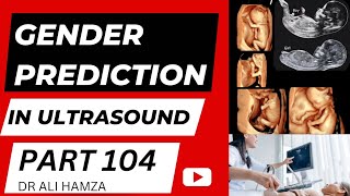 Gender Prediction During Pregnancy In Ultrasound Part 104 [upl. by Nera]