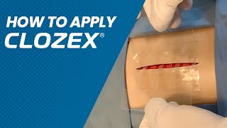 How To Apply ClozexⓇ [upl. by Lacombe]