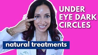 Eye Doctor Explains How To Get Rid Of Dark Under Eye Circles Naturally [upl. by Idurt39]