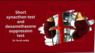 Dexamethasone Suppression Test  Dr Sadiq Ali [upl. by Sheilah]