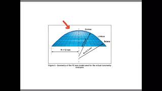 Keratometry  2nd grade  Instruments [upl. by Inele]