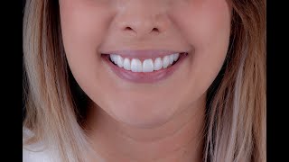 IMPLANTES DENTALES COLOMBIA TURISMO DENTAL DENTISTAS COLOMBIA DENTAL IMPLANT [upl. by Adon]