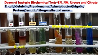 Various Bacteria Biochemical Tests E coli KlebsiellaPseudomonasAcinetobacterProteusMongenella [upl. by Aicram]