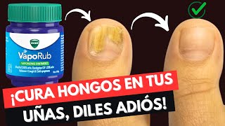 CURA HONGOS EN UÑAS con Vicks Vaporub EVIDENCIA CIENTÍFICA ✅ [upl. by Angrist]